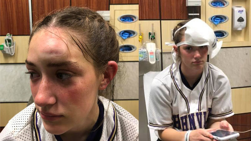 Pitching mask likely saves life of Hahnville player - St. Charles Herald  Guide